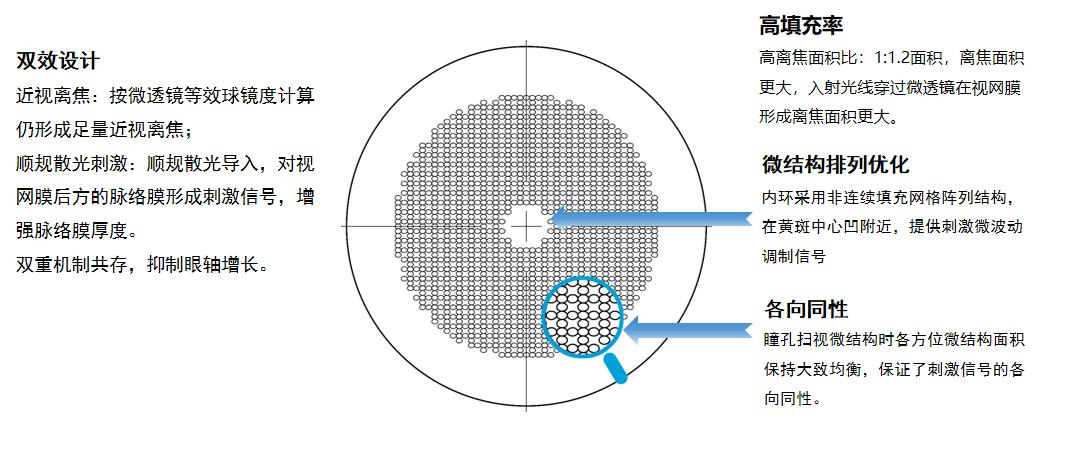 顺规散光刺激技术镜片